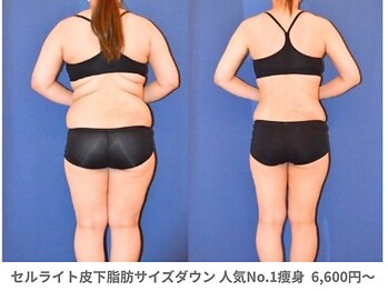 アンシャンテ 神戸元町店(Enchante)/痩身ダイエット　神戸元町三ノ宮