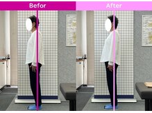 八女整体院/～肩の痛み・腰痛改善～