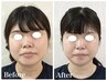 加工級☆【小顔/大きさ/たるみ/歪み】　全身整体付き＋小顔矯正15000→8000　