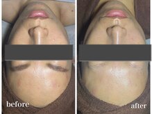 サロンベールカタコリ(BELL)の雰囲気（首肩ケア×フェイシャル 1回で2トーンアップ！発光ツヤ肌♪）