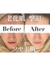 韓国式艶肌管理【デコルテ.ヘッド.パック付】憧れの韓国女優肌へ11,000→
