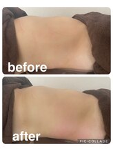 ギンザアール(GINZA R.)/ぽっこりお腹に！