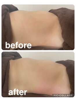 ギンザアール(GINZA R.)/ぽっこりお腹に！