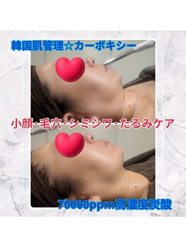 エクラ(Eclat)/結果が見える！カーボキシー