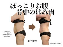 サロン ケイ(Salon K)/ポッコリお腹・ウエストくびれ