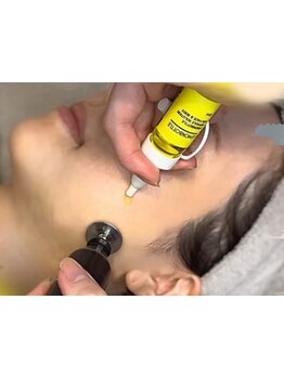 小顔になりたい