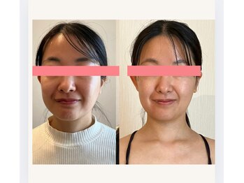 カラダミックス(karadamix)/フェイス・デコルテケア