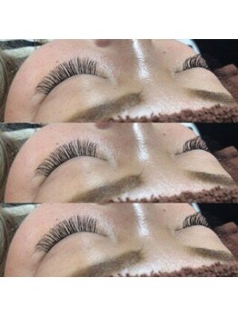 ブロッサ(Blossa)/バインドロック