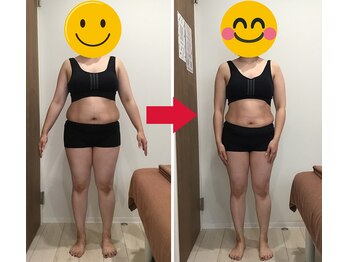 美容整体院元 光の森店/30代 K.Mの様喜びの声