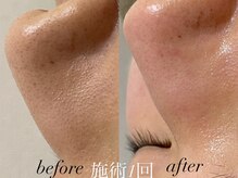 リスポアラボ(LIS PORE.LAB)/