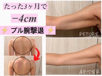 バービーグロウ 恵比寿(Barbie Glow)の写真/圧倒的結果に感動…変わりたいプヨ二の腕・ハミ背中～のお悩みを最短最速で改善！夏までに魅せお腹ゲット！