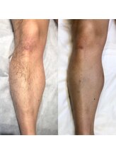 メンズプシュケ(men's PSYCHE)/