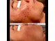 アミュレット(AMULET)の写真