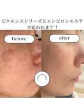 ユヌランコント 岐阜店(Une rencontre)/エンビロン