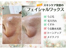 レヴィート(Revept)