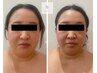 【40代以降】フェイスライン・たるみを整える／小顔ケア体験6,900円