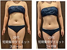 ローブメール(Robemail)/ビフォーアフター