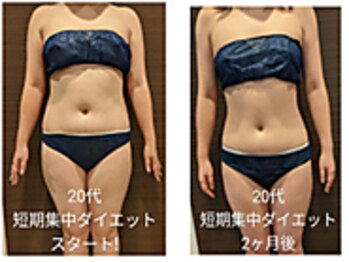 ローブメール(Robemail)/ビフォーアフター