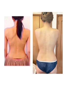 サロン ド ルポゼ(Salon de Reposer)/美乳メソッド