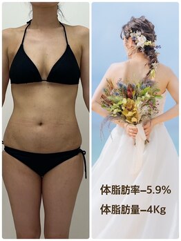 アミクール エステティックサロン(amicoeur)/ドレスが映える体に変身!