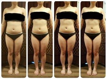 ティティビューティ ラ・クエージ金山(TTBeauty)/1ヶ月の変化