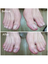 リゼラアンドコー 相模大野店/ドイツ式フットケア専門店