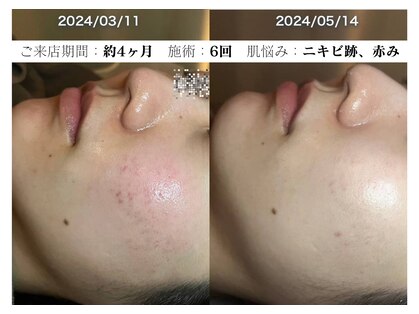 コキュウ メゾン オオサカ(KOKYU MAISON osaka)の写真