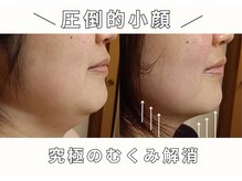 キザシ(kizashi)の雰囲気（強力EMSでむくみ解消！光フォトでお肌を深層から持ち上げる☆）