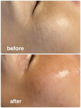 ナイスデイ(Niceday!)/艶玉エステ