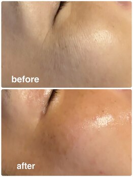 ナイスデイ(Niceday!)/艶玉エステ