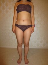 ルメートルセラピー ビューティーサロン(REMETTRE THERAPY)/３０代ダイエット痩身成功例