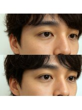 グリット(grit.)/まつ毛パーマ/ラッシュリフト