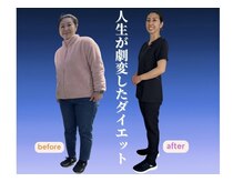ワガママボディだった私が当院のダイエットの正しさを実証！