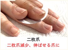 広島深爪専門ネイルサロン　ナッカ/