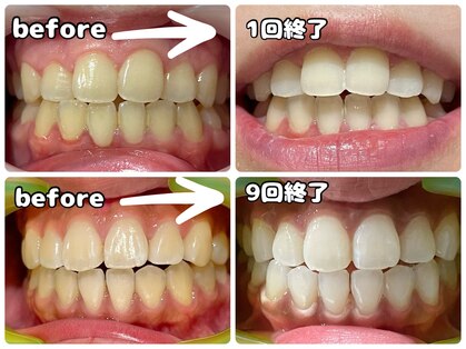 ワイズサロン(Y's salon)の写真