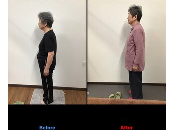 ケアスポット イーズ(care spot e's)の写真/【猫背・巻肩で老けて見えるかも…そんな不安から卒業！】本来の美しい姿勢に戻って自信のある生活を！
