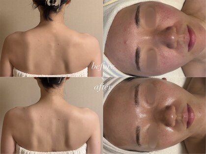 TEN Aesthetic【艶肌・肌質改善・五臓漢方よもぎ蒸し】【7/2　NEW　OPEN（予定）】の写真