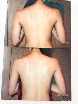 イコット(icotto)/上：BEFOR 下：AFTER