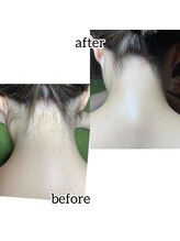 ビューティーデコルルカ(beauty deco ruruka)/成人式前にはWAX脱毛！