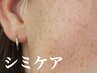 【時短肌育】シミにお悩みの方!美容液導入（アルブチン3g）+超小顔次世代EMS 