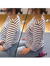 佳整体 大宮/姿勢改善_整体の前後