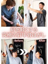 ユニット(unit) 肩こり施術 ご紹介