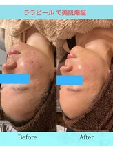 ラ シルク(La silk)/ララピール