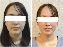 美容整体ウェリナ 名駅院/小顔矯正/骨盤矯正/美脚サロン