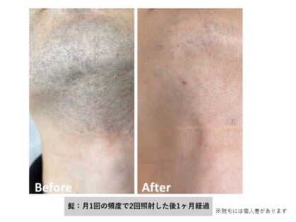 レイカ(Reica)の写真