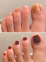 フス(FUSS)/foot&bodycare FUSS