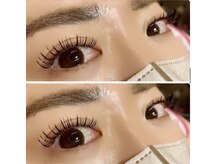 ブロッサ(Blossa)/フラットラッシュ