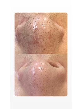 ソリッジ肌管理室/毛穴徹底ケア