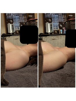 スノードロップ(snowdrop)/