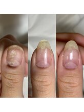 フェミニンネイル(Feminine Nail)/